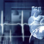 Supply Chain Management in Cardiovascular Device Manufacturing: Key Strategies for Success